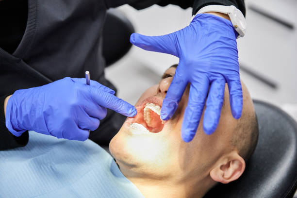 Best Emergency Dental Care for Broken or Chipped Teeth in East Bronson, FL