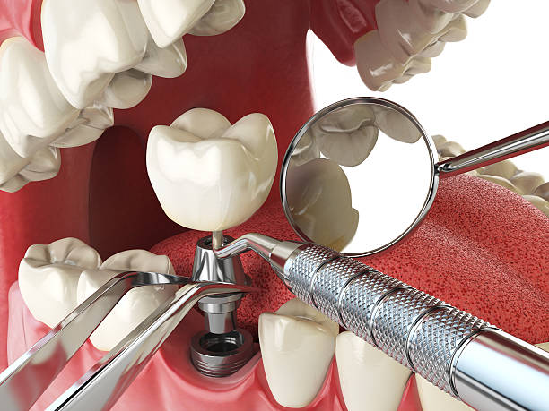 Fast & Reliable Emergency Dental Services in FL